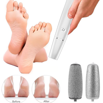 💥 Hot Sale 60% Rabatt💥Elektrischer Hornhautentferner für die Füße👣