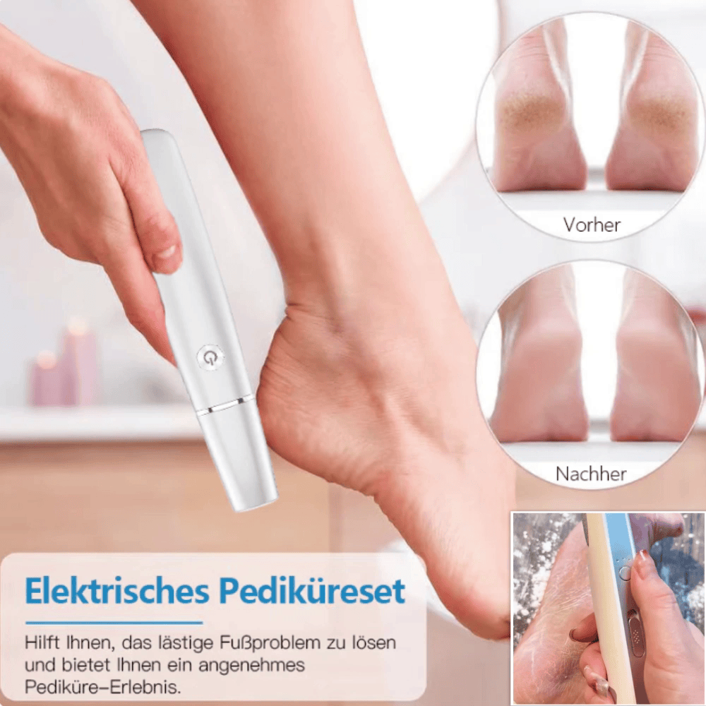 💥 Hot Sale 60% Rabatt💥Elektrischer Hornhautentferner für die Füße👣