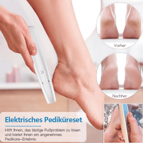 💥 Hot Sale 60% Rabatt💥Elektrischer Hornhautentferner für die Füße👣