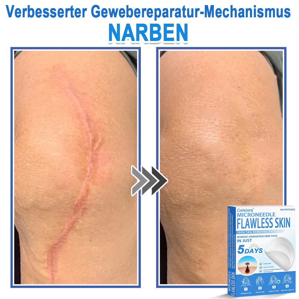 ✅ Celsiora® 2-in-1 Mikronadel- & Hydrokolloid-Pflaster | Entferner für erhabene Muttermale, Akne, flache Warzen & Hautanhängsel | Verbessert Falten, Narben & Hautunreinheiten | Unsichtbare Stern-Pickelpflaster für Gesicht & Körper