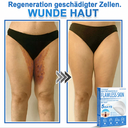 ✅ Celsiora® 2-in-1 Mikronadel- & Hydrokolloid-Pflaster | Entferner für erhabene Muttermale, Akne, flache Warzen & Hautanhängsel | Verbessert Falten, Narben & Hautunreinheiten | Unsichtbare Stern-Pickelpflaster für Gesicht & Körper