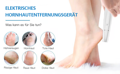 💥 Hot Sale 60% Rabatt💥Elektrischer Hornhautentferner für die Füße👣