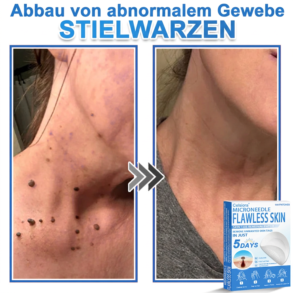 ✅ Celsiora® 2-in-1 Mikronadel- & Hydrokolloid-Pflaster | Entferner für erhabene Muttermale, Akne, flache Warzen & Hautanhängsel | Verbessert Falten, Narben & Hautunreinheiten | Unsichtbare Stern-Pickelpflaster für Gesicht & Körper