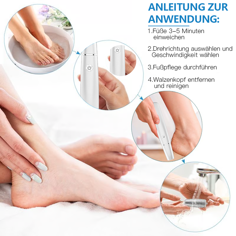 💥 Hot Sale 60% Rabatt💥Elektrischer Hornhautentferner für die Füße👣
