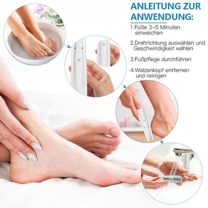 💥 Hot Sale 60% Rabatt💥Elektrischer Hornhautentferner für die Füße👣