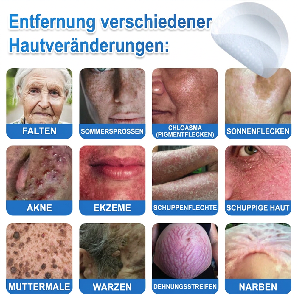 👩‍⚕️ Celsiora® 2-in-1 Mikronadel- & Hydrokolloid-Pflaster | Entferner für erhabene Muttermale, Akne, flache Warzen & Hautanhängsel | Verbessert Falten, Narben & Hautunreinheiten | Unsichtbare Stern-Pickelpflaster für Gesicht & Körper🌿