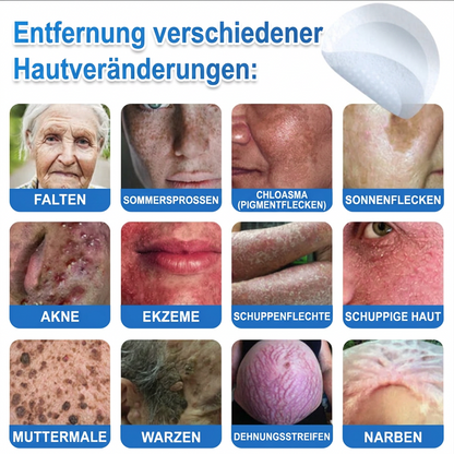 ✅ Celsiora® 2-in-1 Mikronadel- & Hydrokolloid-Pflaster | Entferner für erhabene Muttermale, Akne, flache Warzen & Hautanhängsel | Verbessert Falten, Narben & Hautunreinheiten | Unsichtbare Stern-Pickelpflaster für Gesicht & Körper🌿